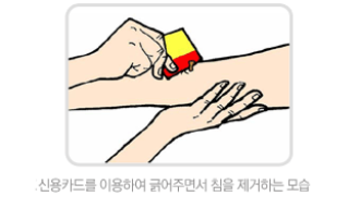 thumbimg